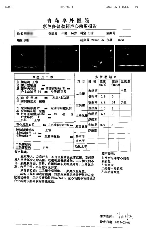 贾江俊教授谈 扩心病最好的治疗方法是什么？